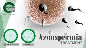 azoospermia-treatment-in-delhi