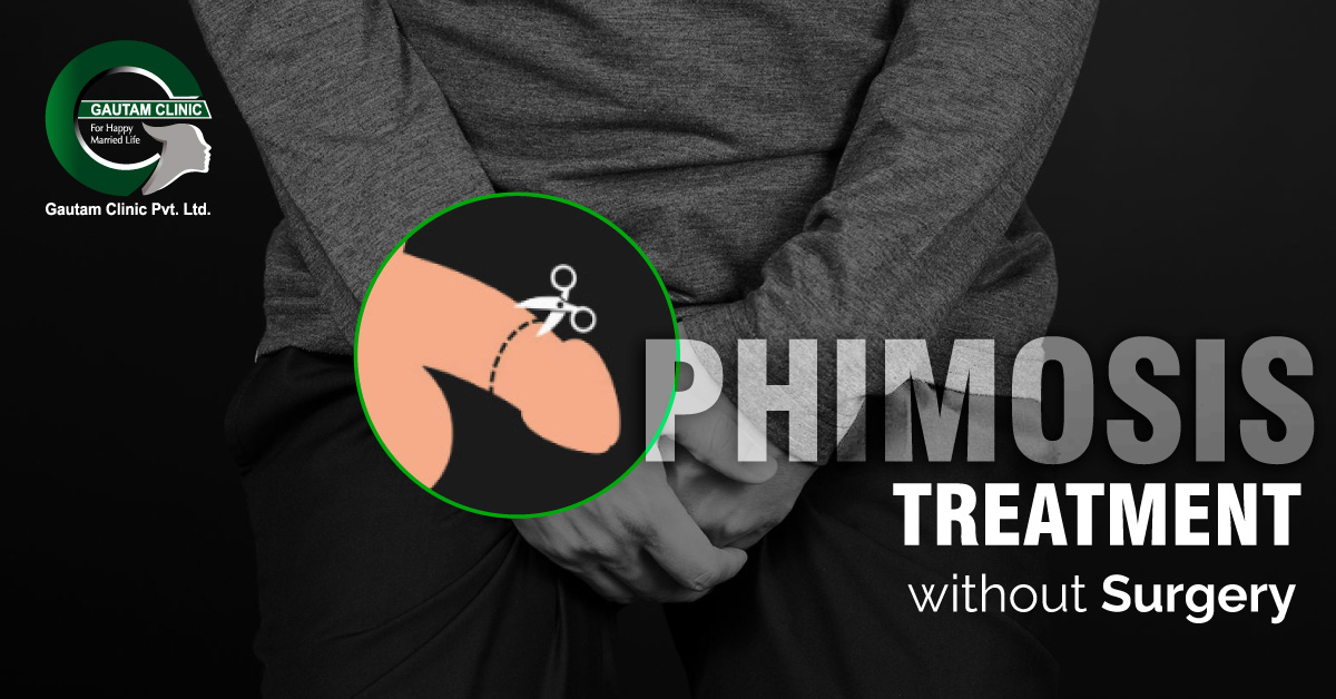 Phimosis Treatment With/Without Surgery in Delhi, India