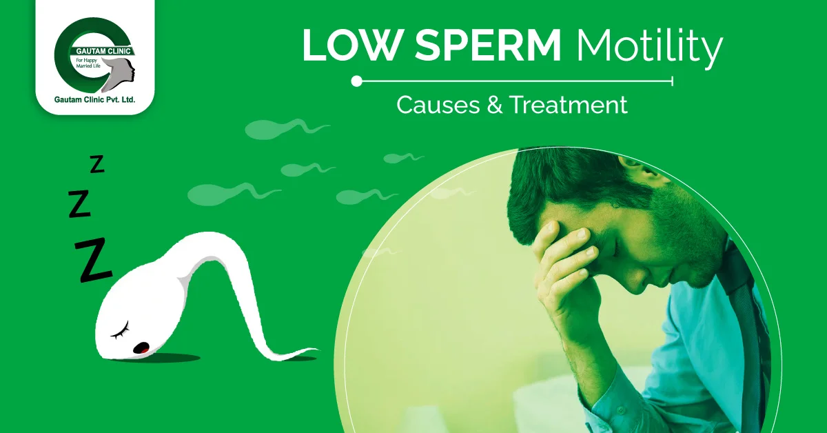 Low Sperm Motility – Causes & Treatment